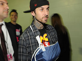 Travis Barker in arm sling